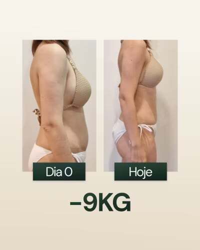-9KG
