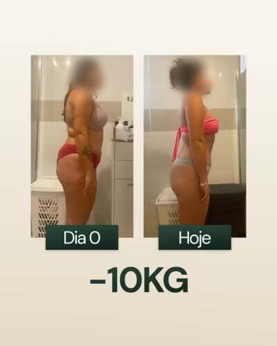 -10KG